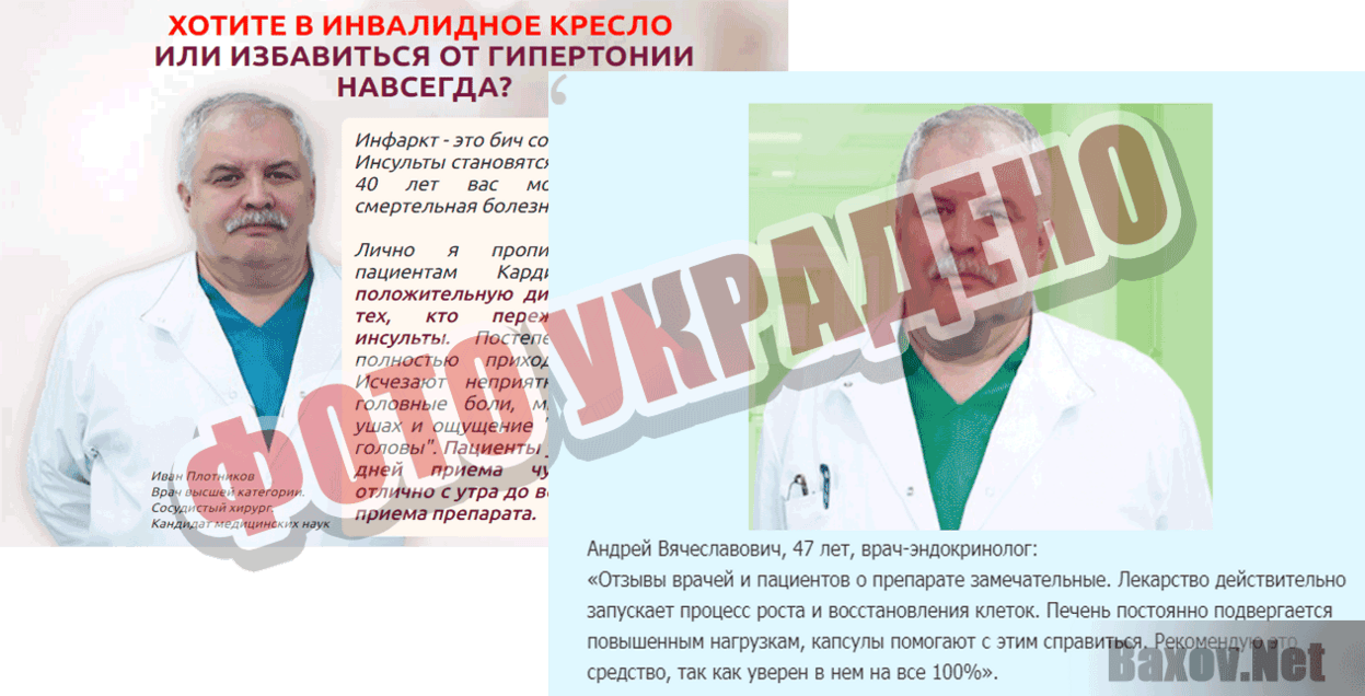 Кардиотонус Фото украдено